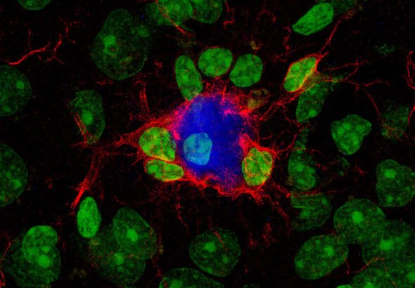 Células con colores brillantes y contrastantes sobre la investigación del alzhéimer