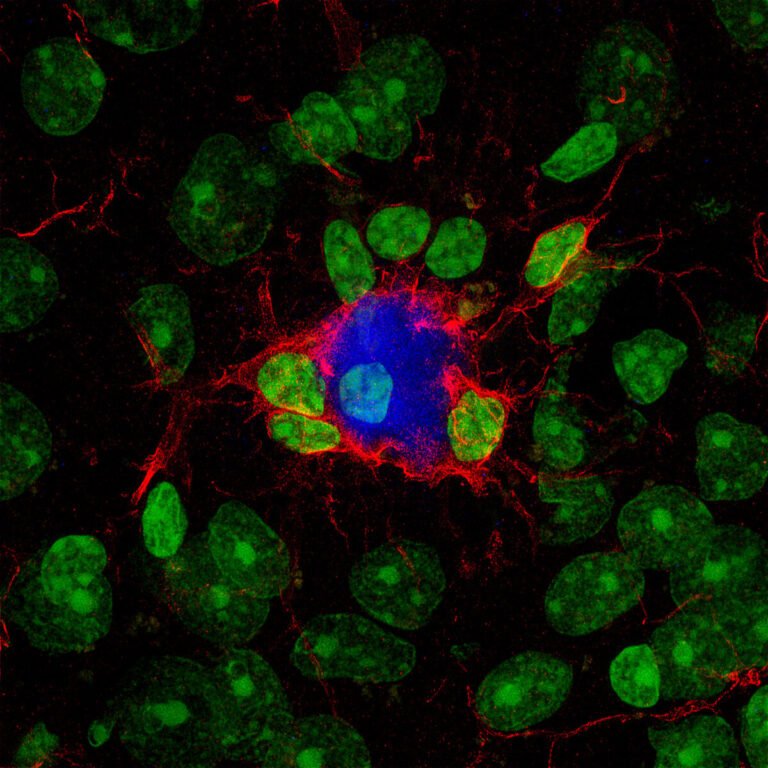 Células con colores brillantes y contrastantes sobre la investigación del alzhéimer